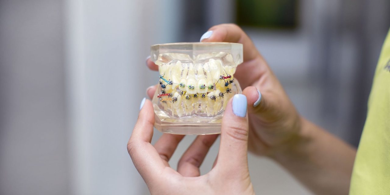 Aparatul dentar Invisalign. De ce să îl alegi ca soluție de tratament ortodontic?