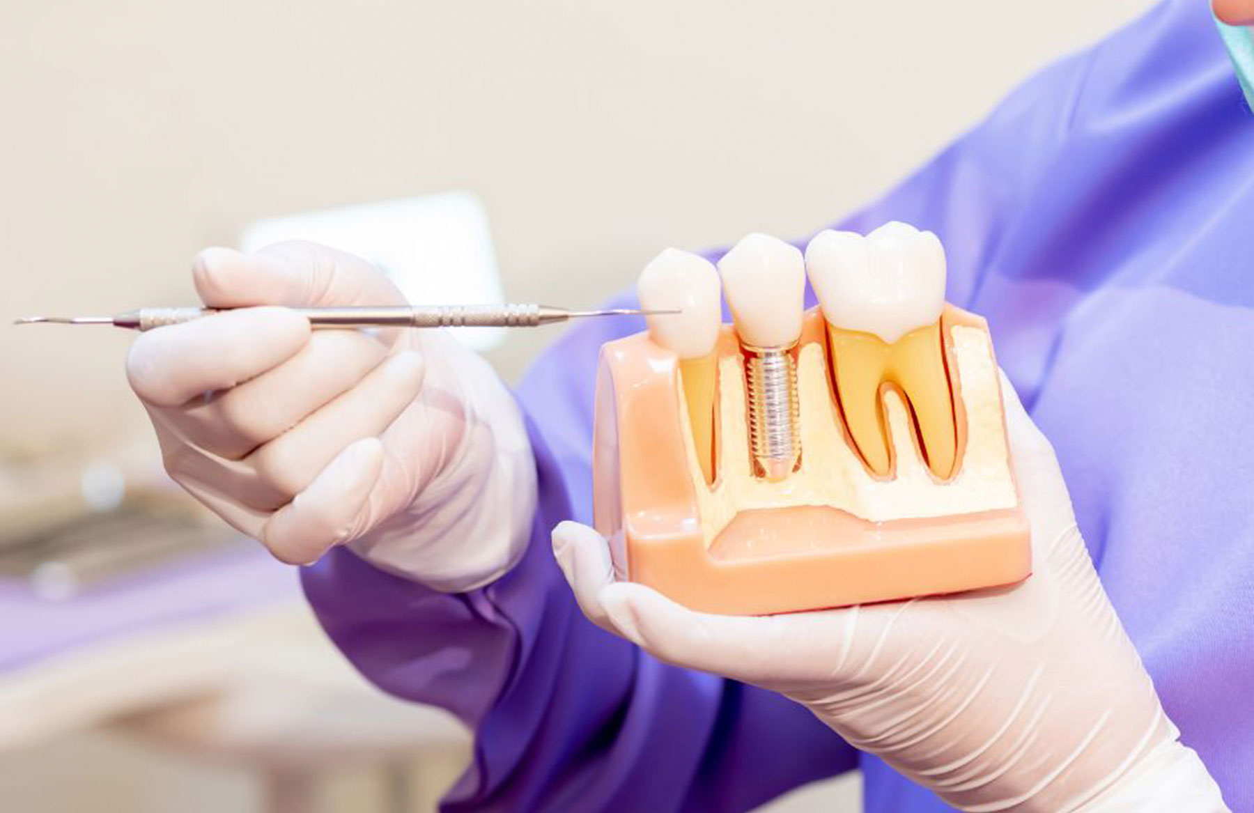 cat-dureaza-aditia-de-os