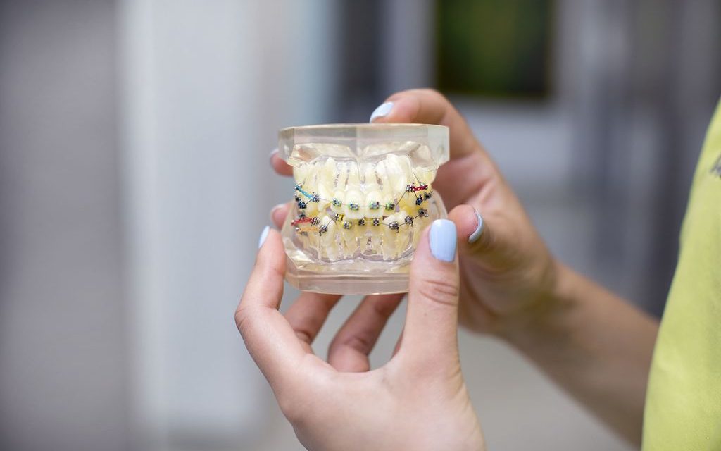 Cât costă un aparat dentar pentru copii și ce implică tratamentul?