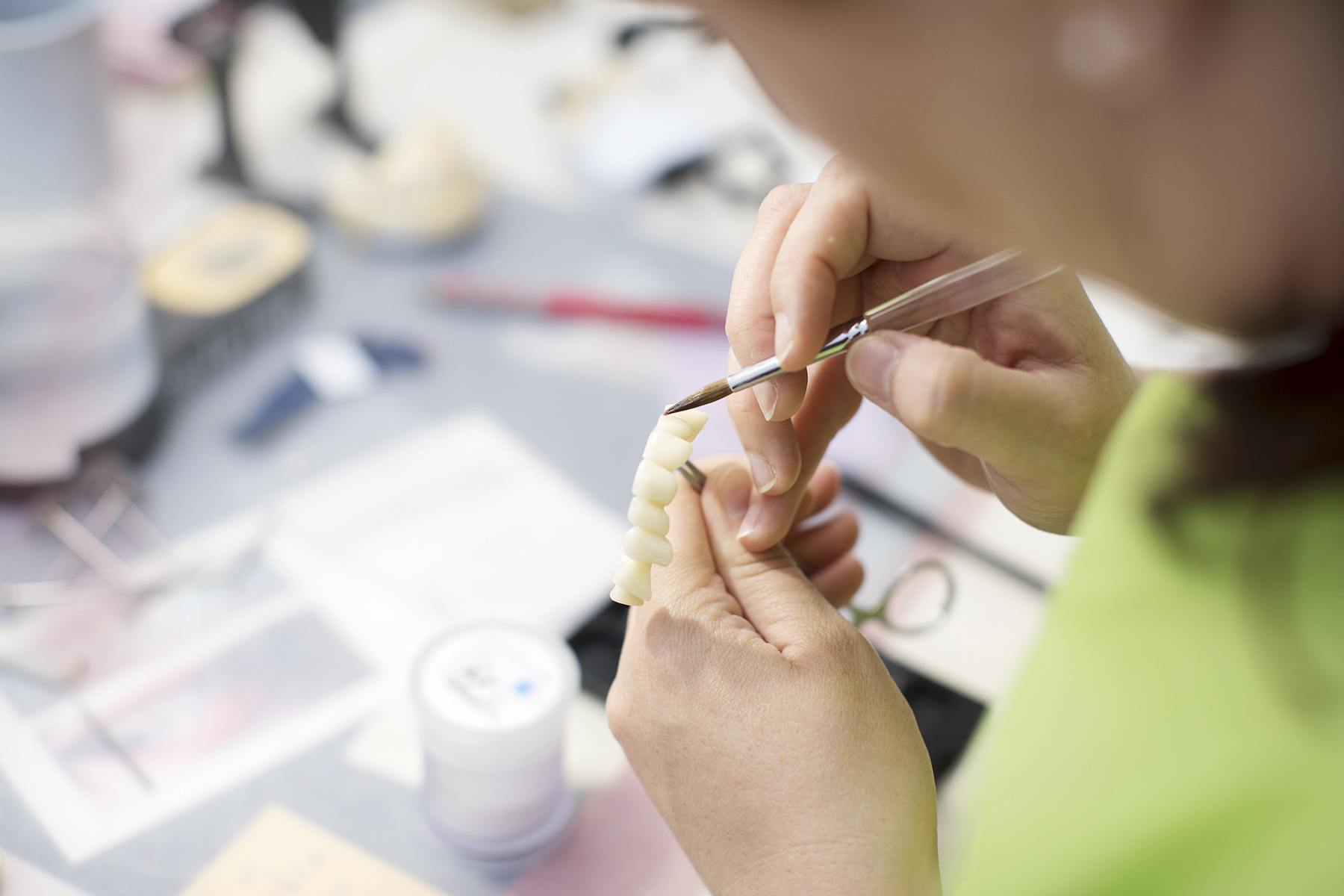 Când să alegi proteza fixă fără implant (1)